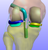 acl_reconstruction_data